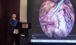 妇科手术视频大全,全面解析各类妇科手术技巧与流程